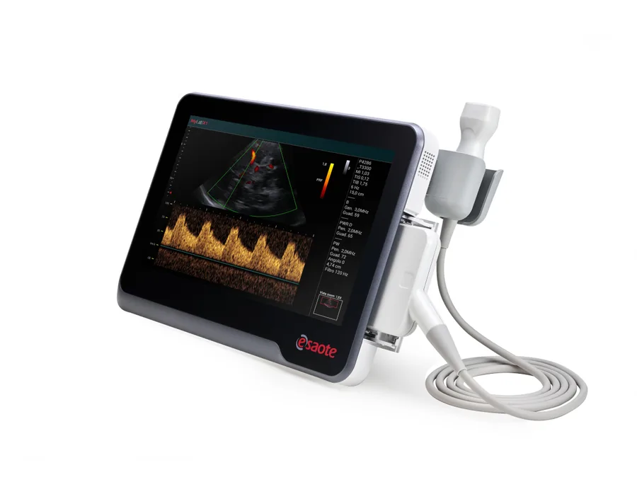 Ultrasonido MyLab™X1