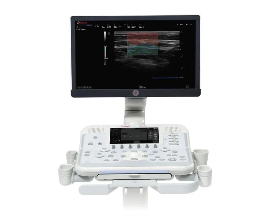 Ultrasonido MyLab™X6