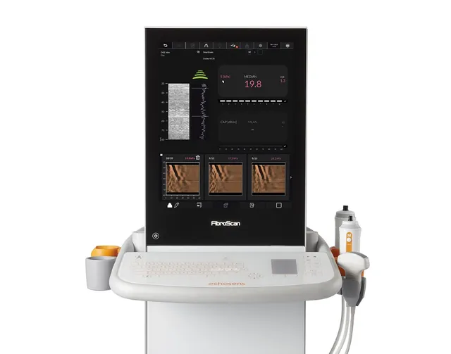 FibroScan® Expert 630