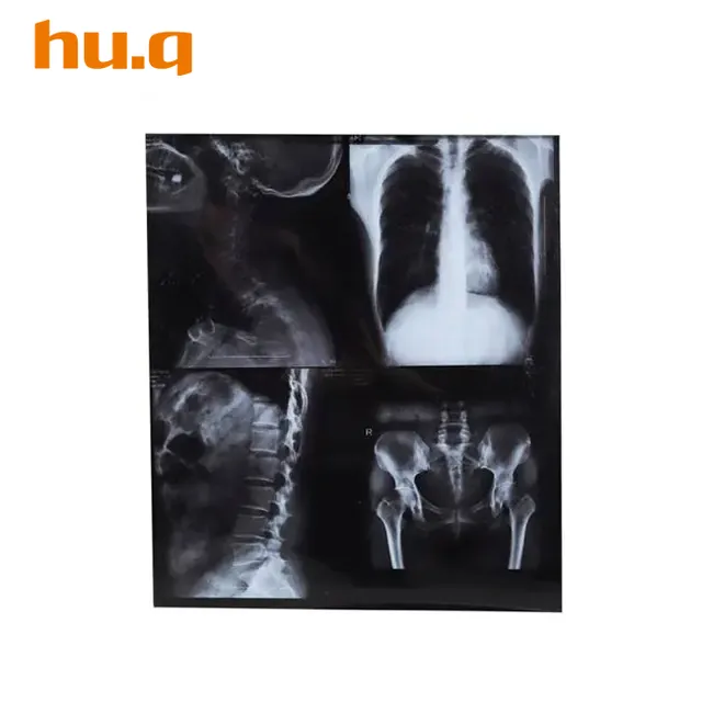 Película KX410 con radiografías