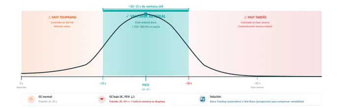 Curva de realce arterial con las zonas muy temprano, ventana arterial y muy tardío, y el pico entre 20 y 25 segundos